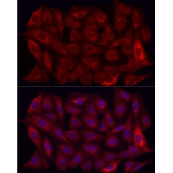 Matrix Metalloproteinase-7 (MMP7) Antibody