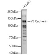 Western blot analysis of lysates from HUVEC cells, using VE Cadherin Antibody at 1/500 dilution. Secondary antibody: HRP-conjugated Goat anti-Rabbit IgG (H+L) at 1/10000 dilution. Lysates/proteins: 25 µg per lane. Blocking buffer: 3% nonfat dry milk in TBST. Exposure time: 60s.