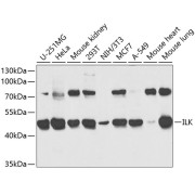 Western blot analysis of various lysates using ILK Antibody at 1/1000 dilution. Secondary antibody: HRP-conjugated Goat anti-Rabbit IgG (H+L) at 1/10000 dilution. Lysates/proteins: 25 µg per lane. Blocking buffer: 3% nonfat dry milk in TBST.