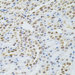 Integrin-Linked Protein Kinase (ILK) Antibody