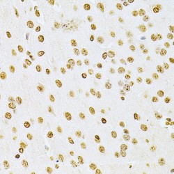 Integrin-Linked Protein Kinase (ILK) Antibody