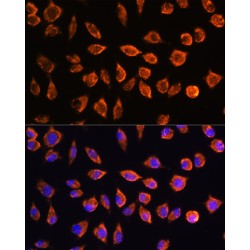 Neurogenic Locus Notch Homolog Protein 3 (NOTCH3) Antibody