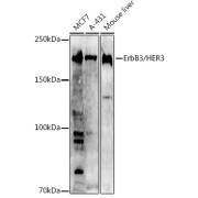 Western blot analysis of various lysates using [KO Validated] ErbB3/HER3 Antibody at 1/1000 dilution. Secondary antibody: HRP-conjugated Goat anti-Rabbit IgG (H+L) at 1/10000 dilution. Lysates/proteins: 25 µg per lane. Blocking buffer: 3% nonfat dry milk in TBST. Exposure time: 180s.