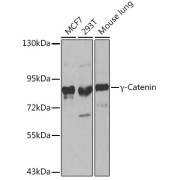 Western blot analysis of various lysates using γ-Catenin Antibody at 1/500 dilution. Secondary antibody: HRP-conjugated Goat anti-Rabbit IgG (H+L) at 1/10000 dilution. Lysates/proteins: 25 µg per lane. Blocking buffer: 3% nonfat dry milk in TBST.