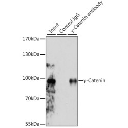 Junction Plakoglobin (JUP) Antibody