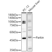 Western blot analysis of lysates from wild type (WT) and 293F cells transfected with Parkin using Parkin Antibody at 1/1000 dilution. Secondary antibody: HRP-conjugated Goat anti-Rabbit IgG (H+L) at 1/10000 dilution. Lysates/proteins: 25 µg per lane. Blocking buffer: 3% nonfat dry milk in TBST. Exposure time: 5s.