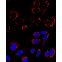 Heat Shock 60 kDa Protein 1, Chaperonin / HSP60 (HSPD1) Antibody