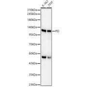 Western blot analysis of various lysates, using PI3 Kinase p110 beta Antibody at 1/2000 dilution. Secondary antibody: HRP-conjugated Goat anti-Rabbit IgG (H+L) at 1/10000 dilution. Lysates/proteins: 25 µg per lane. Blocking buffer: 3% nonfat dry milk in TBST. Exposure time: 10s.