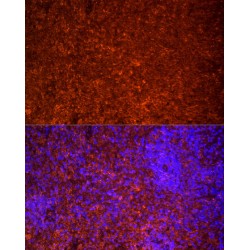 Toll-Like Receptor 7 (TLR7) Antibody