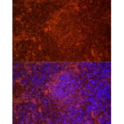 Toll-Like Receptor 7 (TLR7) Antibody