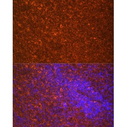 Toll-Like Receptor 7 (TLR7) Antibody