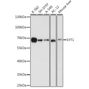 Western blot analysis of various lysates using SYT1 Antibody at 1/1000 dilution. Secondary antibody: HRP-conjugated Goat anti-Rabbit IgG (H+L) at 1/10000 dilution. Lysates/proteins: 25 µg per lane. Blocking buffer: 3% nonfat dry milk in TBST. Exposure time: 10s.