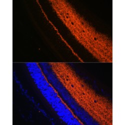 Synaptotagmin 1 (SYT1) Antibody