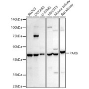 Western blot analysis of various lysates using PAX8 Antibody at 1/1000 dilution. Secondary antibody: HRP-conjugated Goat anti-Rabbit IgG (H+L) at 1/10000 dilution. Lysates/proteins: 25 µg per lane. Blocking buffer: 3% nonfat dry milk in TBST. Exposure time: 180s.