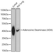 Western blot analysis of various lysates using Adenosine Deaminase (ADA) Antibody at 1/1000 dilution. Secondary antibody: HRP-conjugated Goat anti-Rabbit IgG (H+L) at 1/10000 dilution. Lysates/proteins: 25 µg per lane. Blocking buffer: 3% nonfat dry milk in TBST. Exposure time: 5s.