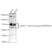 Western blot analysis of various lysates, using Alpha-1 Antichymotrypsin (SERPINA3) Antibody at 1/400 dilution. Secondary antibody: HRP-conjugated Goat anti-Rabbit IgG (H+L) at 1/10000 dilution. Lysates/proteins: 25 µg per lane. Blocking buffer: 3% nonfat dry milk in TBST. Exposure time: 60s.