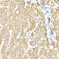 Keratin, Type II Cytoskeletal 8 (KRT8) Antibody