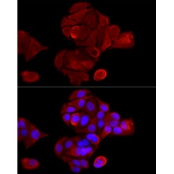 Keratin, Type II Cytoskeletal 8 (KRT8) Antibody