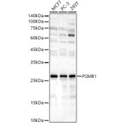 Western blot analysis of various lysates, using PSMB1 Antibody at 1/3500 dilution. Secondary antibody: HRP-conjugated Goat anti-Rabbit IgG (H+L) at 1/10000 dilution. Lysates/proteins: 25 µg per lane. Blocking buffer: 3% nonfat dry milk in TBST. Exposure time: 180s.