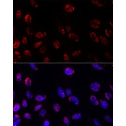 Proteasome Subunit Beta Type 1 (PSMB1) Antibody