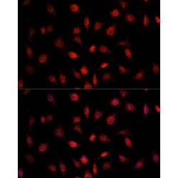 Proteasome Subunit Beta Type 1 (PSMB1) Antibody