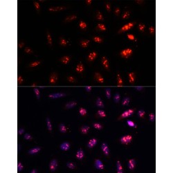 Proteasome Subunit Beta Type 1 (PSMB1) Antibody