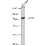 Western blot analysis of lysates from rat liver, using NUAK2 Antibody at 1/1000 dilution. Secondary antibody: HRP-conjugated Goat anti-Rabbit IgG (H+L) at 1/10000 dilution. Lysates/proteins: 25 µg per lane. Blocking buffer: 3% nonfat dry milk in TBST. Exposure time: 60s.