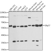 Western blot analysis of various lysates using ERp57 Antibody at 1/1000 dilution. Secondary antibody: HRP-conjugated Goat anti-Rabbit IgG (H+L) at 1/10000 dilution. Lysates/proteins: 25 µg per lane. Blocking buffer: 3% nonfat dry milk in TBST. Exposure time: 30s.