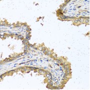 Immunohistochemistry analysis of paraffin-embedded Human prostate using RNASE11 Antibody at dilution of 1/100 (40x lens). Microwave antigen retrieval performed in 0.01 M PBS Buffer (pH 7.2) prior to IHC staining.