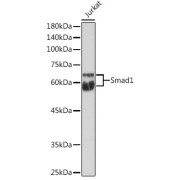 Western blot analysis of lysates from Jurkat cells, using Smad1 Antibody at 1/1000 dilution. Secondary antibody: HRP-conjugated Goat anti-Rabbit IgG (H+L) at 1/10000 dilution. Lysates/proteins: 25 µg per lane. Blocking buffer: 3% nonfat dry milk in TBST. Exposure time: 180s.