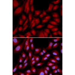 BAG Family Molecular Chaperone Regulator 1 (BAG1) Antibody