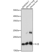 Western blot analysis of various lysates using IL1β Antibody at 1/1000 dilution. Secondary antibody: HRP-conjugated Goat anti-Rabbit IgG (H+L) at 1/10000 dilution. Lysates/proteins: 25 µg per lane. Blocking buffer: 3% nonfat dry milk in TBST. Exposure time: 180s.