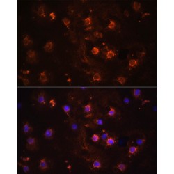 Interleukin 1 Beta (IL1B) Antibody