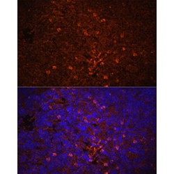 Interleukin 1 Beta (IL1B) Antibody