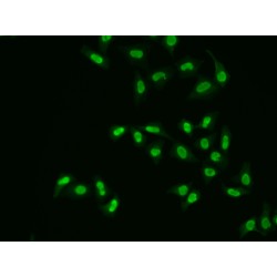 DNA-(Apurinic Or Apyrimidinic Site) Lyase (APEX1) Antibody