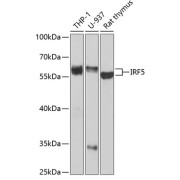 Western blot analysis of various lysates using IRF5 Antibody at 1/1000 dilution. Secondary antibody: HRP-conjugated Goat anti-Rabbit IgG (H+L) at 1/10000 dilution. Lysates/proteins: 25 µg per lane. Blocking buffer: 3% nonfat dry milk in TBST. Exposure time: 90s.