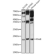 Western blot analysis of various lysates using RheB Antibody at 1/1000 dilution. Secondary antibody: HRP-conjugated Goat anti-Rabbit IgG (H+L) at 1/10000 dilution. Lysates/proteins: 25 µg per lane. Blocking buffer: 3% nonfat dry milk in TBST. Exposure time: 60s.