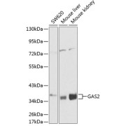 Western blot analysis of various lysates using GAS2 Antibody at 1/1000 dilution. Secondary antibody: HRP-conjugated Goat anti-Rabbit IgG (H+L) at 1/10000 dilution. Lysates/proteins: 25 µg per lane. Blocking buffer: 3% nonfat dry milk in TBST.