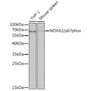 Western blot analysis of various lysates using NOXA2/p67phox Antibody at 1/1000 dilution. Secondary antibody: HRP-conjugated Goat anti-Rabbit IgG (H+L) at 1/10000 dilution. Lysates/proteins: 25 µg per lane. Blocking buffer: 3% nonfat dry milk in TBST.