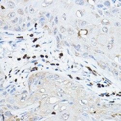 Neutrophil Cytosolic Factor 2 (NCF2) Antibody