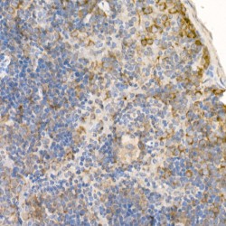 RAB5A, Member RAS Oncogene Family (RAB5A) Antibody