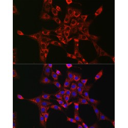 RAB5A, Member RAS Oncogene Family (RAB5A) Antibody