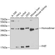 Western blot analysis of various lysates using FHIT Antibody at 1/1000 dilution. Secondary antibody: HRP-conjugated Goat anti-Rabbit IgG (H+L) at 1/10000 dilution. Lysates/proteins: 25 µg per lane. Blocking buffer: 3% nonfat dry milk in TBST.