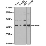 Western blot analysis of various lysates using RASSF1 Antibody at 1/1000 dilution. Secondary antibody: HRP-conjugated Goat anti-Rabbit IgG (H+L) at 1/10000 dilution. Lysates/proteins: 25 µg per lane. Blocking buffer: 3% nonfat dry milk in TBST.