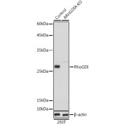 Western blot analysis of lysates from wild type (WT) and RhoGDI knockout (KO) 293T cells, using [KO Validated] RhoGDI Antibody at 1/1000 dilution. Secondary antibody: HRP-conjugated Goat anti-Rabbit IgG (H+L) at 1/10000 dilution. Lysates/proteins: 25 µg per lane. Blocking buffer: 3% nonfat dry milk in TBST. Exposure time: 1s.