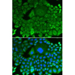 Rho GDP-Dissociation Inhibitor 1 (ARHGDIA) Antibody