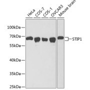 Western blot analysis of various lysates using STIP1 Antibody at 1/1000 dilution. Secondary antibody: HRP-conjugated Goat anti-Rabbit IgG (H+L) at 1/10000 dilution. Lysates/proteins: 25 µg per lane. Blocking buffer: 3% nonfat dry milk in TBST.