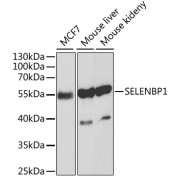 Western blot analysis of various lysates using [KO Validated] SELENBP1 Antibody at 1/1000 dilution. Secondary antibody: HRP-conjugated Goat anti-Rabbit IgG (H+L) at 1/10000 dilution. Lysates/proteins: 25 µg per lane. Blocking buffer: 3% nonfat dry milk in TBST.