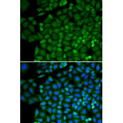 Selenium-Binding Protein 1 (SELENBP1) Antibody