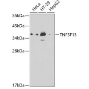 Western blot analysis of various lysates using TNFSF13 Antibody at 1/1000 dilution. Secondary antibody: HRP-conjugated Goat anti-Rabbit IgG (H+L) at 1/10000 dilution. Lysates/proteins: 25 µg per lane. Blocking buffer: 3% nonfat dry milk in TBST.